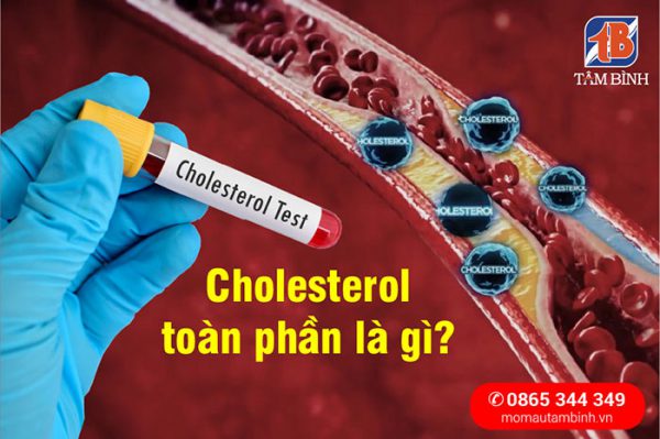 Cholesterol toàn phần là gì